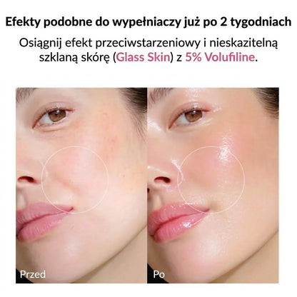 Serum Collagen