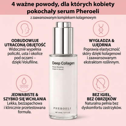 4 powody
