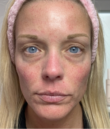 Marina, 38